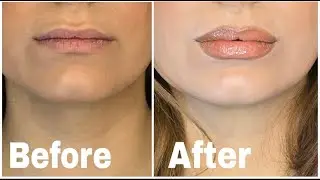 The easiest way to fake big lips with makeup without injections|*quick and beginner friendly*
