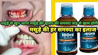 Himalaya Hiora mouthwash price and review #hioramouthwash #gums #gumsproblam #dentalcare 