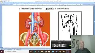 Arterial Disorders in Arabic 3 ( Arterial Embolism , ) , by Dr. Wahdan .