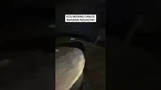 Very sad In Ghana ECG missing Cables. Watch it for yourself