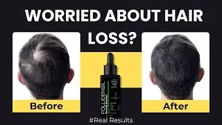 Follidensil 18.5% Growth Booster Serum | Redensyl, Procapil, Anagain & Kopexil for Hair Growth 