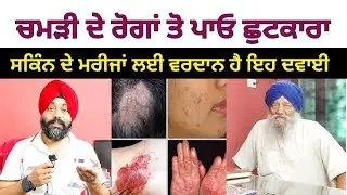 ਚਮੜੀ ਰੋਗ ਦੇ ਮਰੀਜਾਂ ਲਈ ਹੈ ਇਹ ਵੀਡੀਓ | चमड़ी रोग का पक्का इलाज | Treatment of Skin | @dstalanian