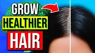 TOP 14 BIOTIN Rich Foods That Promote Hair GROWTH & Stops Hair Loss