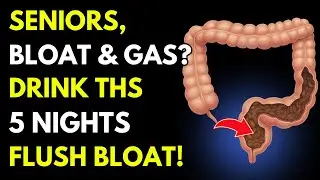 SENIORS, Drink THIS for 5 Nights to Cleanse Your Gut! | Senior Wellness | gut health senior