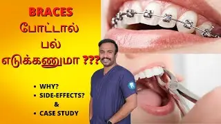 BRACES போட்டால் பல் எடுக்கணுமா? | Orthodontic Extraction of Premolars | Why Removing Teeth? | Dr.MKP