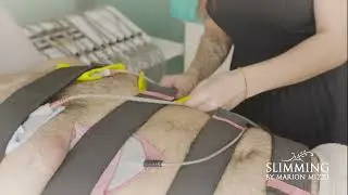 Muscle Stimulation