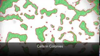 Bacterial Colony + Cell Counting Made Easy with MIPAR
