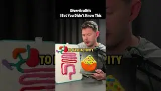 Every Diverticulitis Patient Has This Brain Pattern