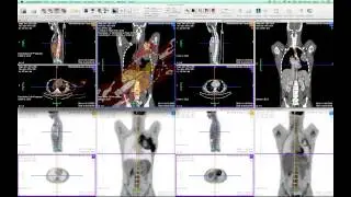 FusionSync Tutorial - Part 04: Manual Fusion Method