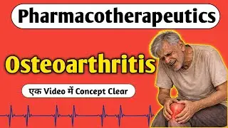क्या होता है Osteoarthritis 9 Minutes में समझो | Musculoskeletal Disorders | Pharmacotherapeutics