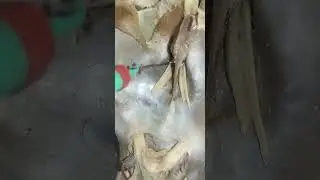 Olfactory bulb forms a tract called olfactory tract