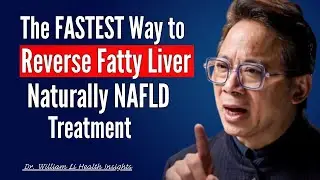 The FASTEST Way to Reverse Fatty Liver, Naturally _ NAFLD Treatment. Dr William Li Health Insights