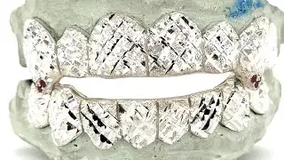 How to cover missing teeth with grillz | Seattle Gold Grills