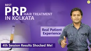 PRP Treatment in Kolkata | 4th Session Results Shocked Me! |Patient Experience at Calcutta Cosmo Aid