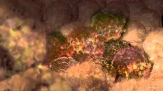 Cancer Cells Undergoing Mitosis