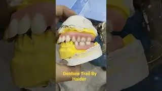 RPD Procedure ||| Denture Trail By Haider..#dentalartbyhaider   #dentures