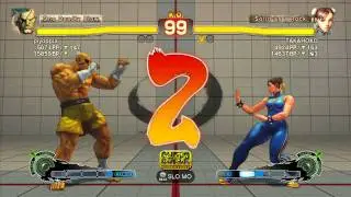 AFG (Sagat) vs TAKAHOKO (Chun-Li) - SSF4 Arcade Edition Xbox Live Ranked Match