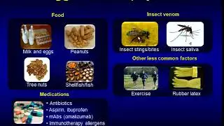 10/01/13 Anaphylaxis: Causes, Diagnosis, and Treatment