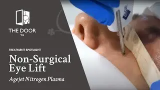 AgeJET for Eye Rejuvenation | The Door W4 | Non-Surgical Eye Lift Using Nitrogen Plasma