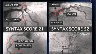 New Perspectives in Coronary Artery Disease Lessons from SYNTAX