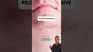 Le SOPK (syndrome des ovaires polykystiques) est un trouble hormonal fr&eacute;quent mais encore mal