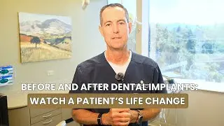 Before-and-After Dental Implants: A Real Smile Transformation Story
