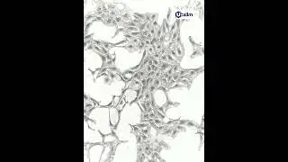 A Guide to Avoiding Pitfalls in Culturing HEK293 Cells