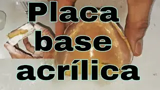 Cómo se hace una placa dental base acrílica #protesisdental