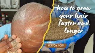 how to grow your hair faster and longer #captureride #haircare #jamalgota #hair #viralvideo