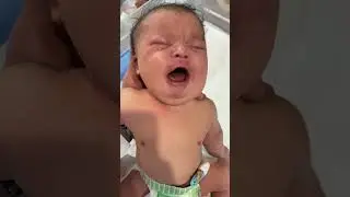 NICU Newborn Baby | Severe Facial Swelling | Medical Awareness Video #cutebaby #patientbaby