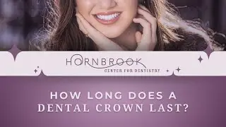 How Long Does a Dental Crown Last? | Hornbrook Center for Dentistry