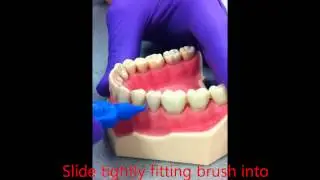 Using Interdental-cleaning aids