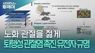 노화 관절을 젊게&hellip;퇴행성 관절염 촉진 유전자 규명 / YTN 사이언스