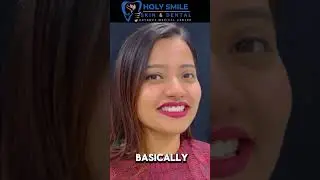Vineeta's Smile Makeover: Veneer Treatment in Kolkata by Dr. Nandi!