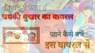 Chamki fever or Encephalitis Syndrome ||चमकी बुखार ||