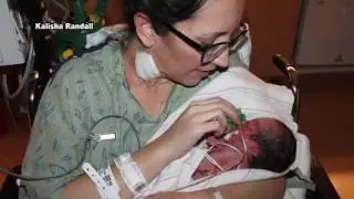 Mom and baby survive life-threatening birth