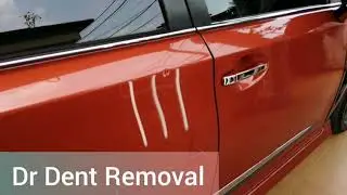 Dr Dent Removal Malaysia 2019