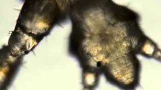 Observation of INSECT - KOREABIO MICROSCOPE