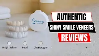 Shiny Smile Veneers Review – Worth the Money or a Scam?