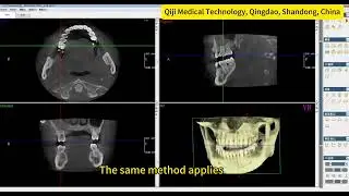 Meyer  Used Dental CBCT&ndash; High Resolution, Fast Scanning 