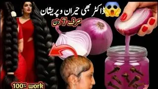 🧅Hair Falling Out Try This Onion Juice Remedy for Crazy Regrowth🌱hair fall solution at home