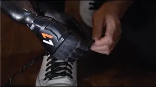 How to use Vulcan Myoelectric Hand | Daily Use