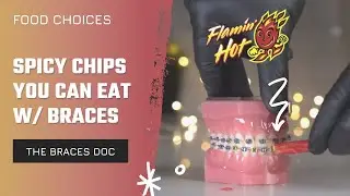 What can you eat with braces (Food Choices) Spicy Flamin&rsquo; Hot Chips Edition - ASMR w/ The Braces Doc