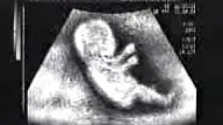 Baby_drawin_car(www.tamilwap.info).3gp