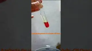 𝙏𝙚𝙨𝙩 𝙛𝙤𝙧 𝘼𝙡𝙘𝙤𝙝𝙤𝙡𝙞𝙘 -𝙊𝙃 𝙂𝙧𝙤𝙪𝙥🧪#shorts #science #chemistry #practical #experiment #explore #art #love