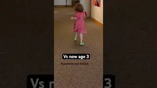 Can you see the difference? Time is what helps #shorts #specialneeds #hypotonia #toddlers #running