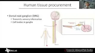 SPARC Seminar - Characterizing novel RNA isoforms using long-read sequencing in the hDRG