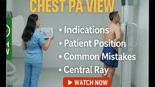 CHEST PA X-RAY POSITIONING MADE EASY | TIPS,MISTAKES AND TECHNIQUES|Radiology Tech