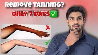 Hand tanning removal tips || Tan remove naturally || Tan removal 7 day challenge || apnadawaikhana