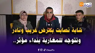 سناء شابة آية في الجمال ملي تزوجات ولدات تصابت بمرض غريب ونادر وتتوجه للمغاربة بنداء مؤثر